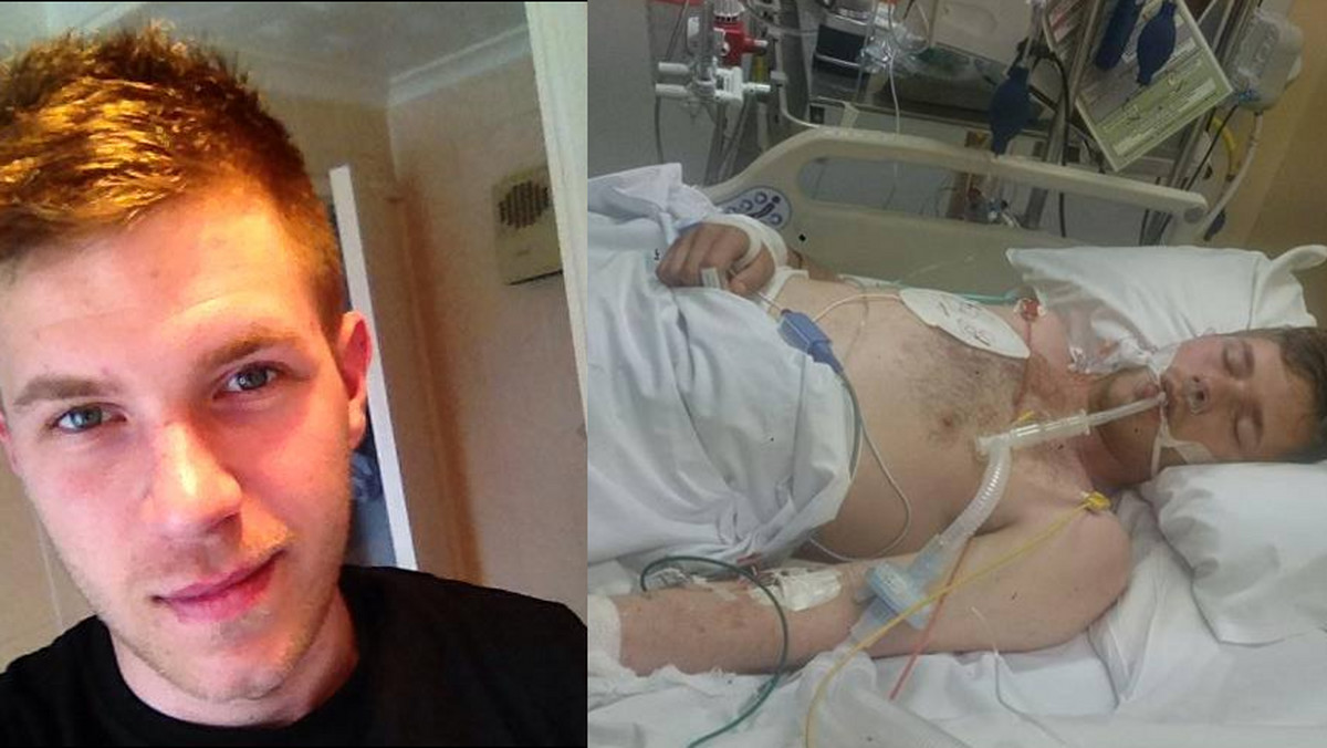 20-letni Jordan Blackburn przez trzy dni przebywał w śpiączce po zażyciu narkotyków na jednym z festiwali. Jego kolega zmarł z przedawkowania. Teraz Jordan opowiada swoją historię i przestrzega rówieśników - czytamy w portalu buzzfeed.com.
