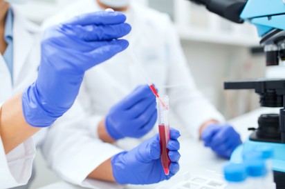 Egy vérvizsgálat mentette meg a fiatal nőt a ráktól – ez tűnt fel neki az átlagos tünetek között