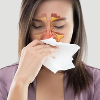 Visszatérő arcüreggyulladás: orrpolip és reflux is állhat a háttérben