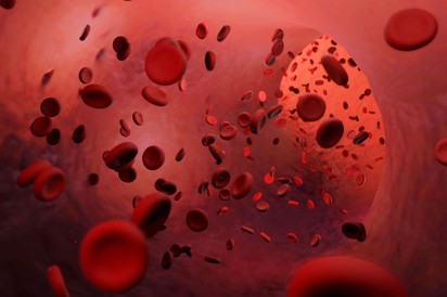 Stroke-előjelek: ilyen érzés, amikor agyvérzést kap az ember