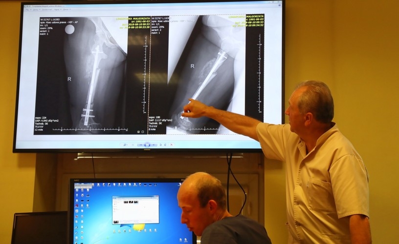 INNOWACYJNA OPERACJA WYDŁUŻENIA KOŚCI
