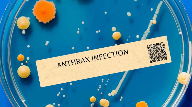 Anthrax (lépfene)