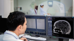 Tomografia komputerowa głowy - jak interpretować wyniki?