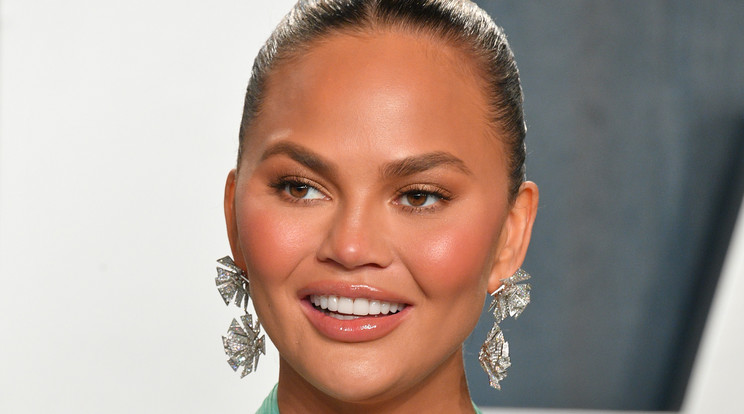 Chrissy Teigen gyanús narancsba harapott, feldagadt a szája / Fotó: GettyImages