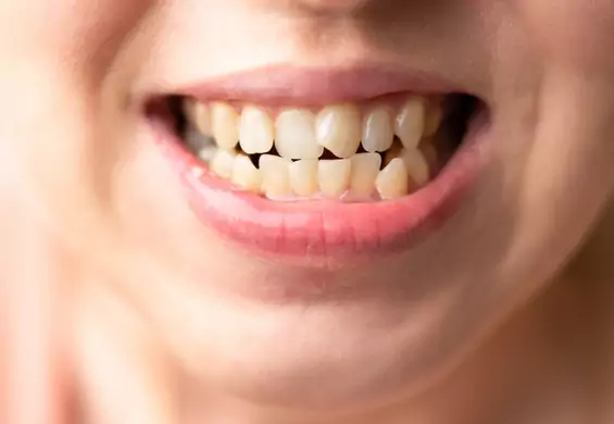 Sennik: zęby. Czy sen o zębach to zła wróżba? Poznaj jego znaczenie