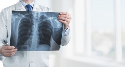 Ezért olyan veszélyes a COPD