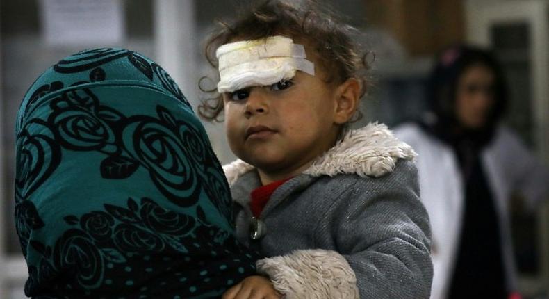 A wounded Iraqi child who was injured during the ongoing fighting between Iraqi forces and jihadists of the Islamic State group in Mosul, receives medical treatment at a hospital in Arbil on December 19, 2016