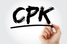 CPK wchodzi w fazę realizacji. Inwestycja nabiera niespotykanego dotąd rozpędu. Jest 19 wniosków o pozwolenia na budowę