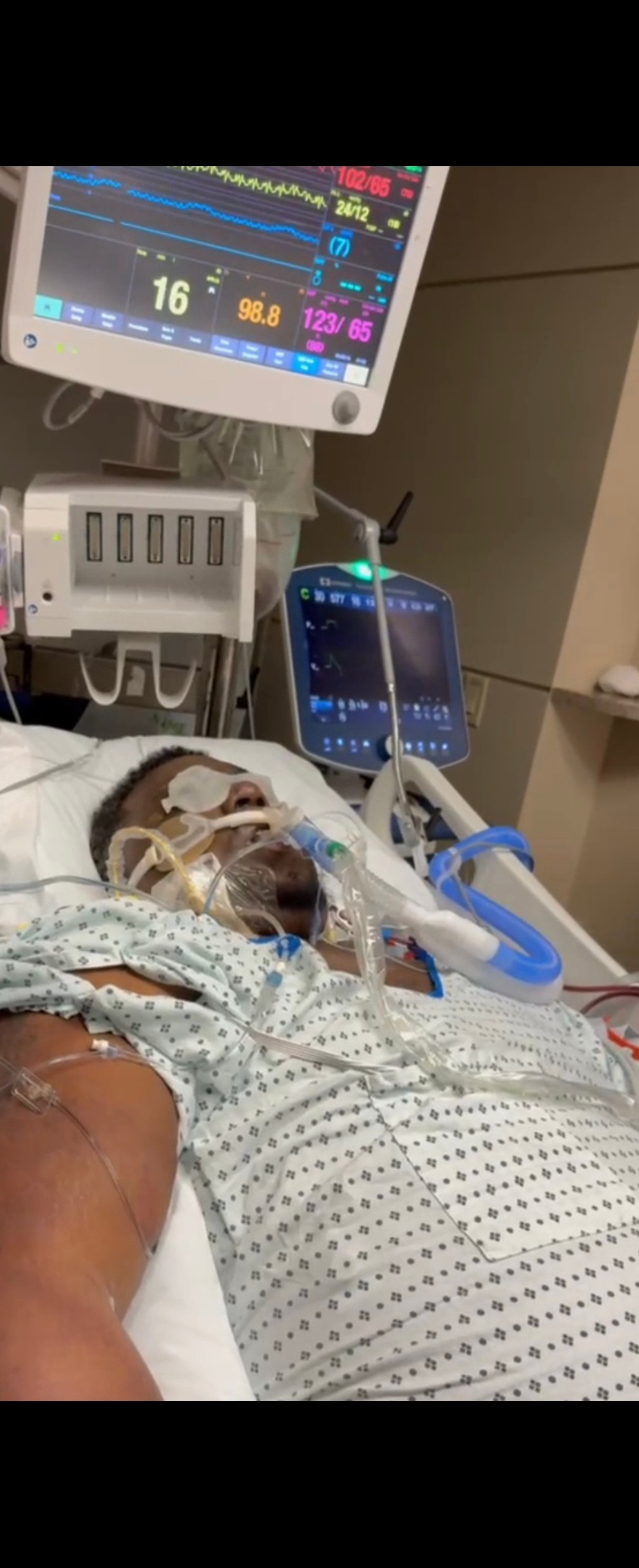 Preventívna prehliadka u zubára sa pre Davona skončila amputáciou končatín.