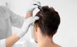 Dlaczego warto badać skórę głowy?
