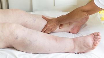 a lábak duzzanata okozza lüktető fájdalom az ízületben