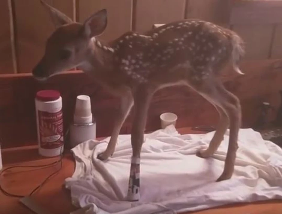 privremena proteza za nogu