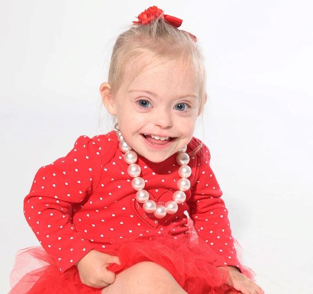 Megkönnyezed! Nézd, milyen szeretnivaló a mosolyuk a Down-szindrómás  babáknak! Ez a kislány pedig egyenesen modellkarriert futott be! - Blikk  Rúzs