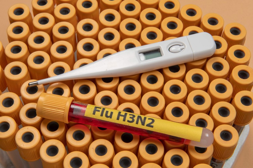 A(H3N2) tip virusa gripa je letos pretrpeo mutacije 
