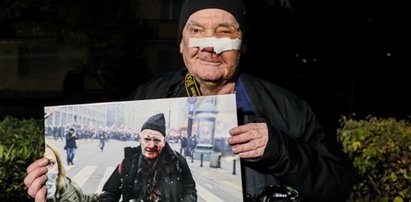 Postrzelony fotoreporter żąda odszkodowania. „Może to być nawet sześć zer”