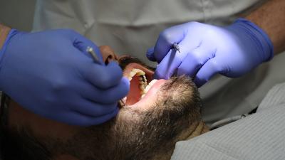 Zęby z probówki. Czy tak będzie wyglądała rewolucja w stomatologii?