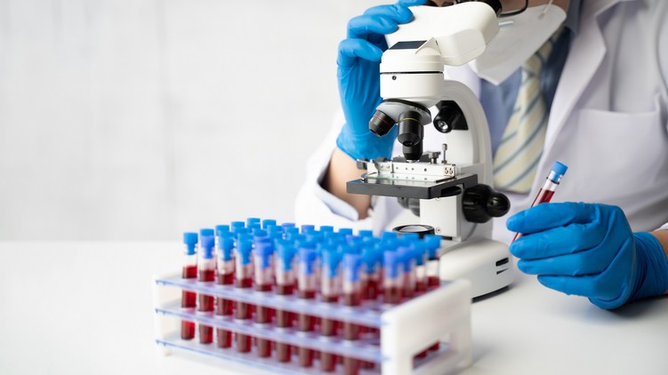 kóros trombocita szám  ok betegség hematológia vérkép