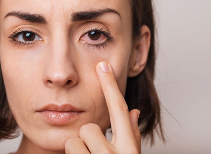 Mit jelent, ha viszket a bal szemem? című cikk nyitóképe