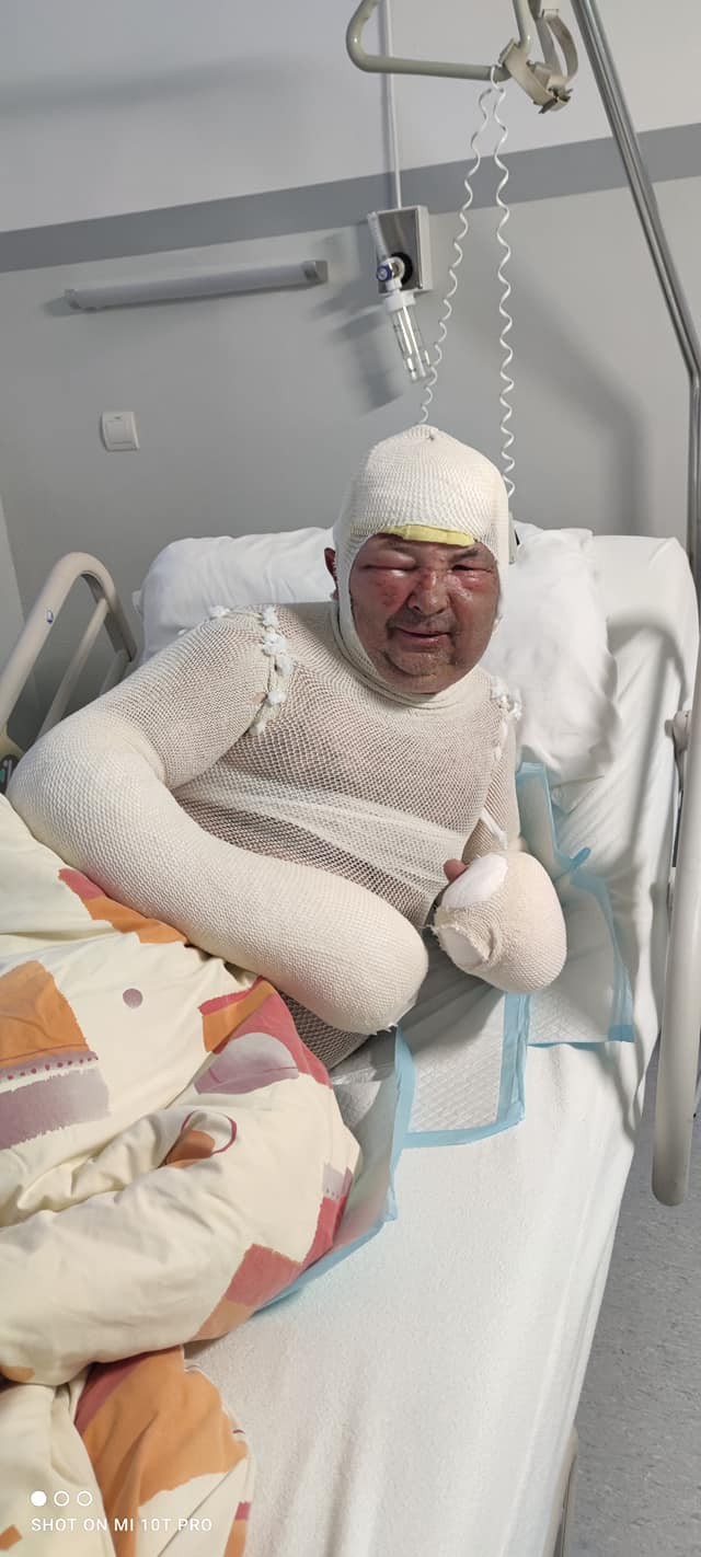 Ondrej utrpel bolestivé zranenia. 