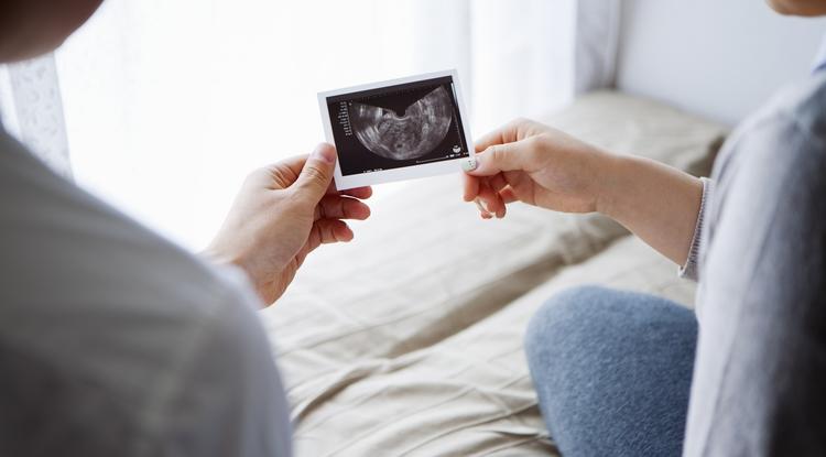 A kismama megmutatta az ultrahangképet kisbabájáról Fotó: Getty Images