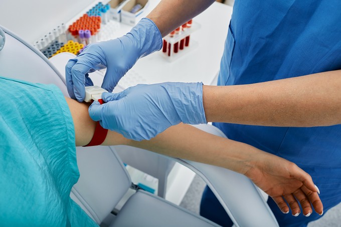 Vastagbélrák szűrés vérvizsgálattal? Ebben az esetben válthatja ki a kolonoszkópiát