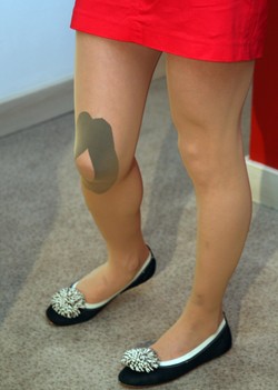 Tak wygląda noga Justyny Kowalczyk po operacji