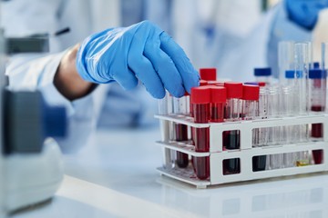 Mit jelent a leukocyta (WBC) érték a laborleleten?