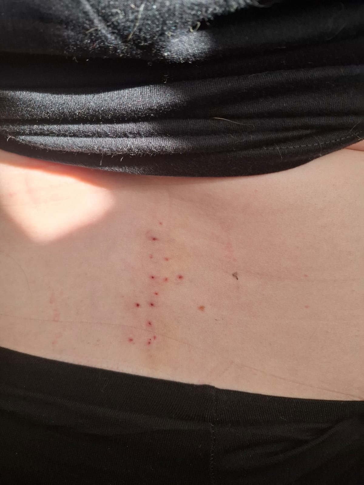 Grace Pammant  trpí zriedkavým ochorením mozgu.