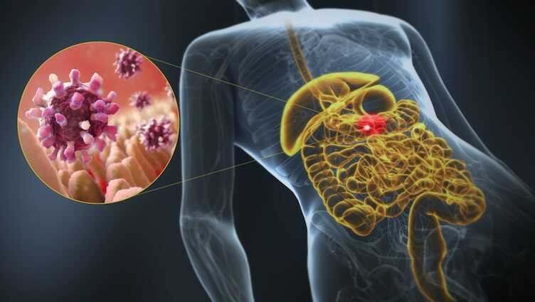 Gastroenteritis, a 3D medical illustration of affected organ highlight. Disease affects the intestines (Science journal) 