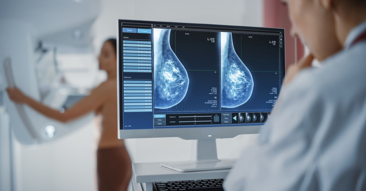 Pacjentki chore na raka piersi muszą jeszcze poczekać na refundację testów wielogenowych