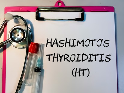 Hashimoto-betegség: tünetei, lefolyása, kezelése - orvosi válaszok a tévhitekre