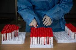 Omikron w Singapurze. Dwa przypadki u kobiet zaszczepionych trzecią dawką