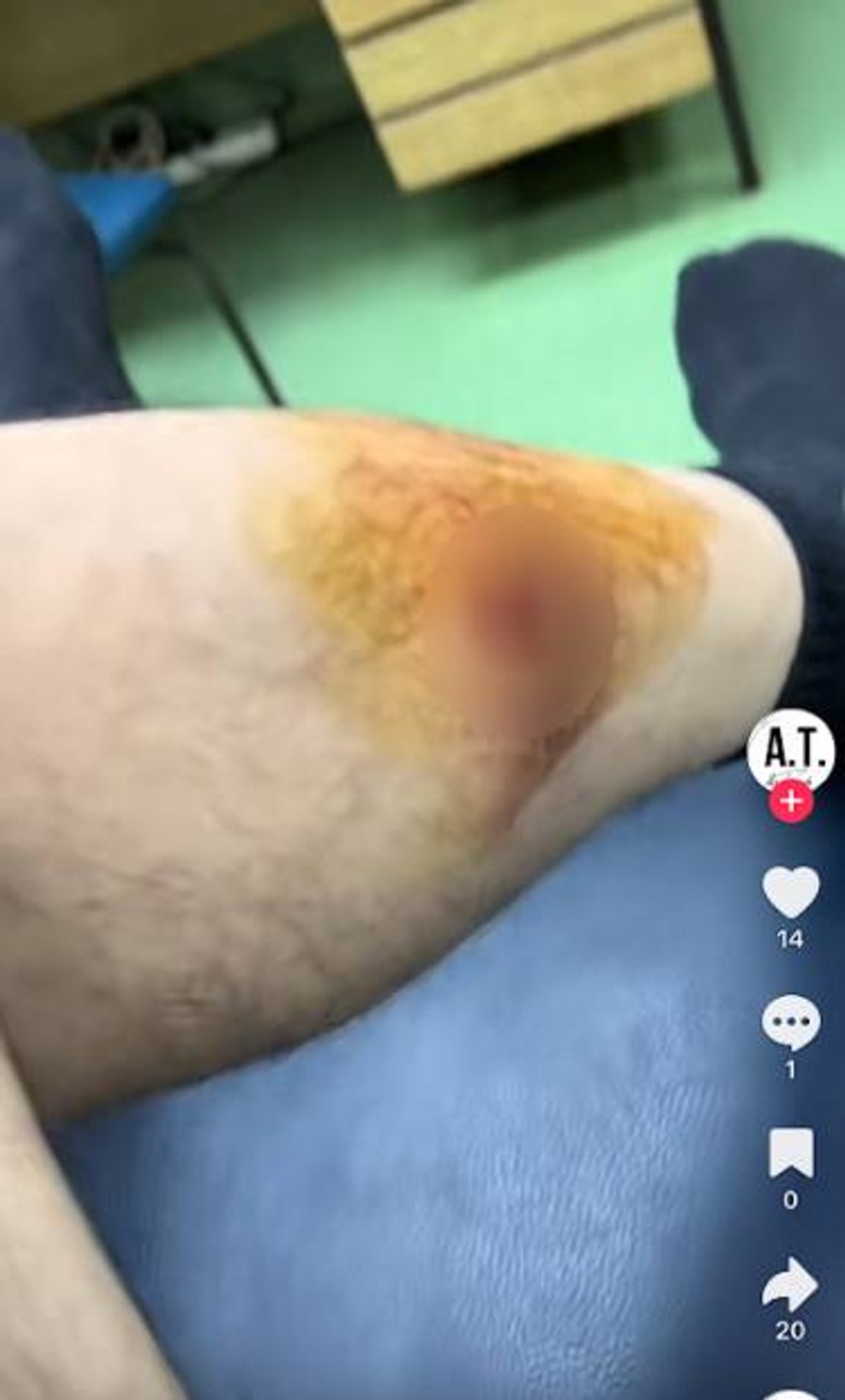 Upucan Andrija Terzić