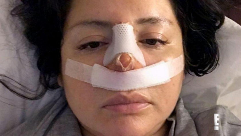 Obudziła się z bandażami na twarzy. Chirurg upiększył ją wbrew jej woli