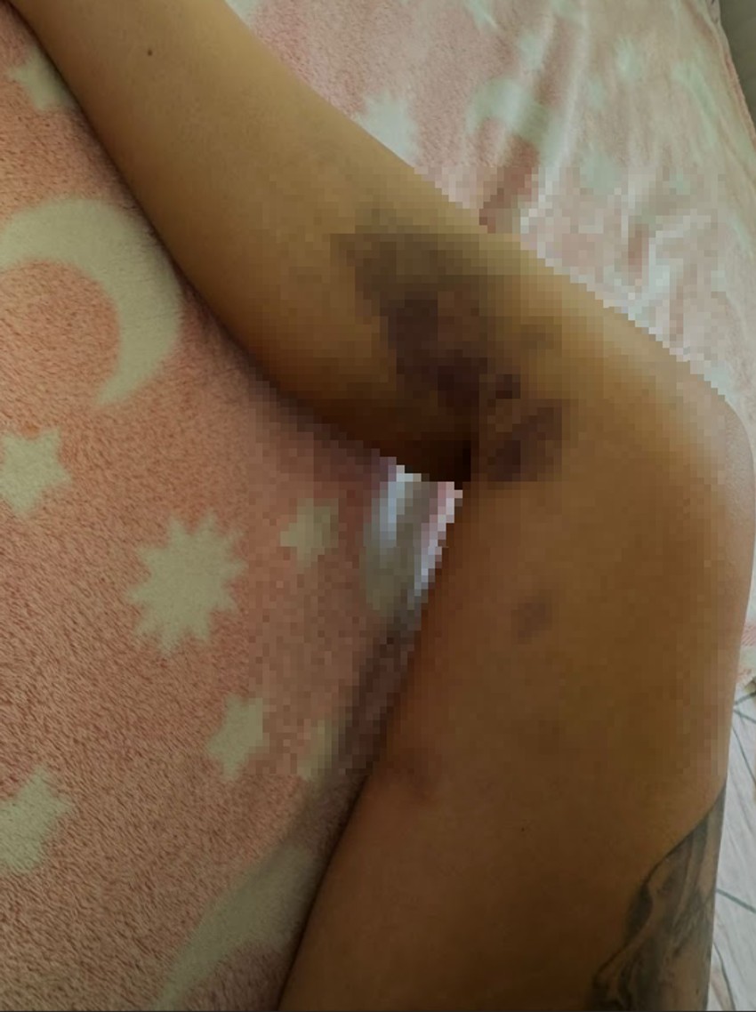 Aleksandrine modrice