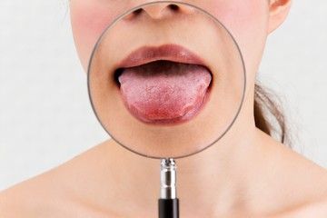 Amikor a halitózis nem orális eredetű, mindig az alapbetegség kezelése a fontos, anélkül a kellemetlen szájszag akkor sem szüntethető meg, ha figyelnek a szájhigiéniára.