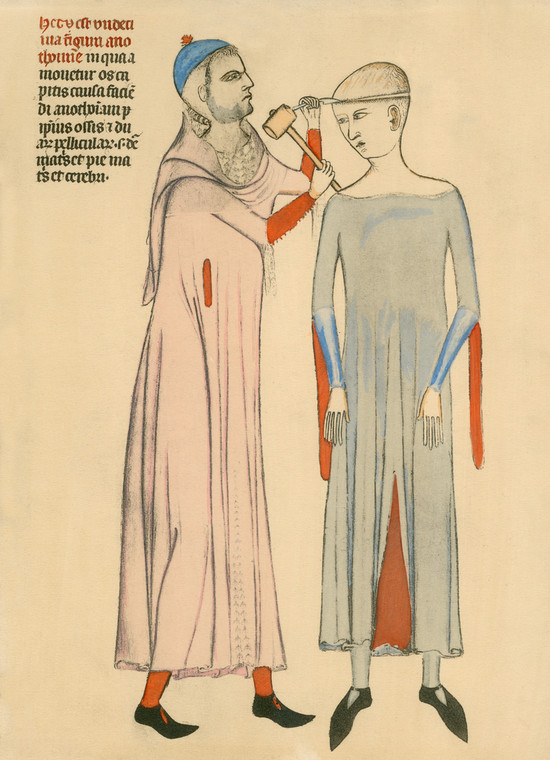 Średniowieczne metody leczenia