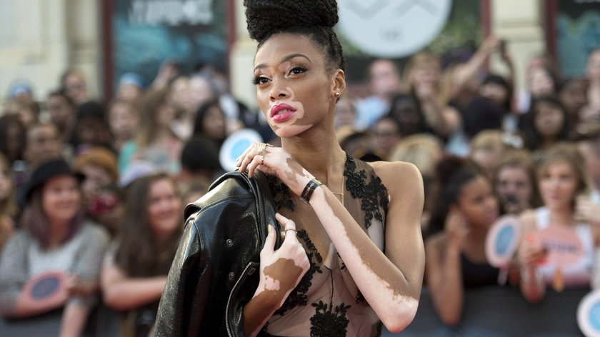 Winnie Harlow