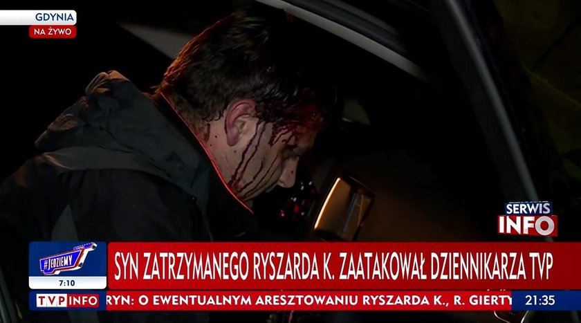 Gdynia: Przeszukanie domu Ryszarda Krauze. Operator TVP pobity