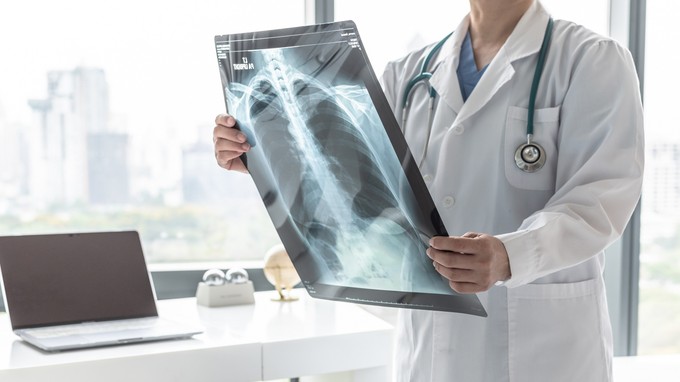 COPD: 500 ezer krónikus tüdőbeteg élhet Magyarországon, akik gyengébb tüdővel harcolnak a koronavírus ellen