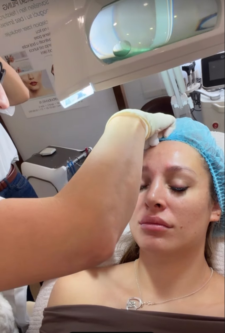 Luna Đogani ubrizgava botoks u lice, snimala se tokom tretmana