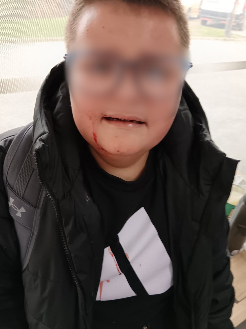 V.S, učenik iz Vlasotinca, vršnjačko nasilje