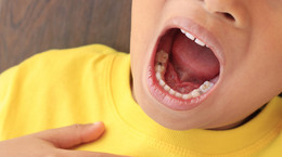 Próchnica zębów u dzieci - przyczyny i leczenie. Czym jest próchnica butelkowa?