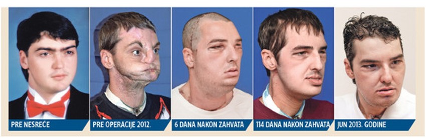 Ričard Noris i njegovo novo lice