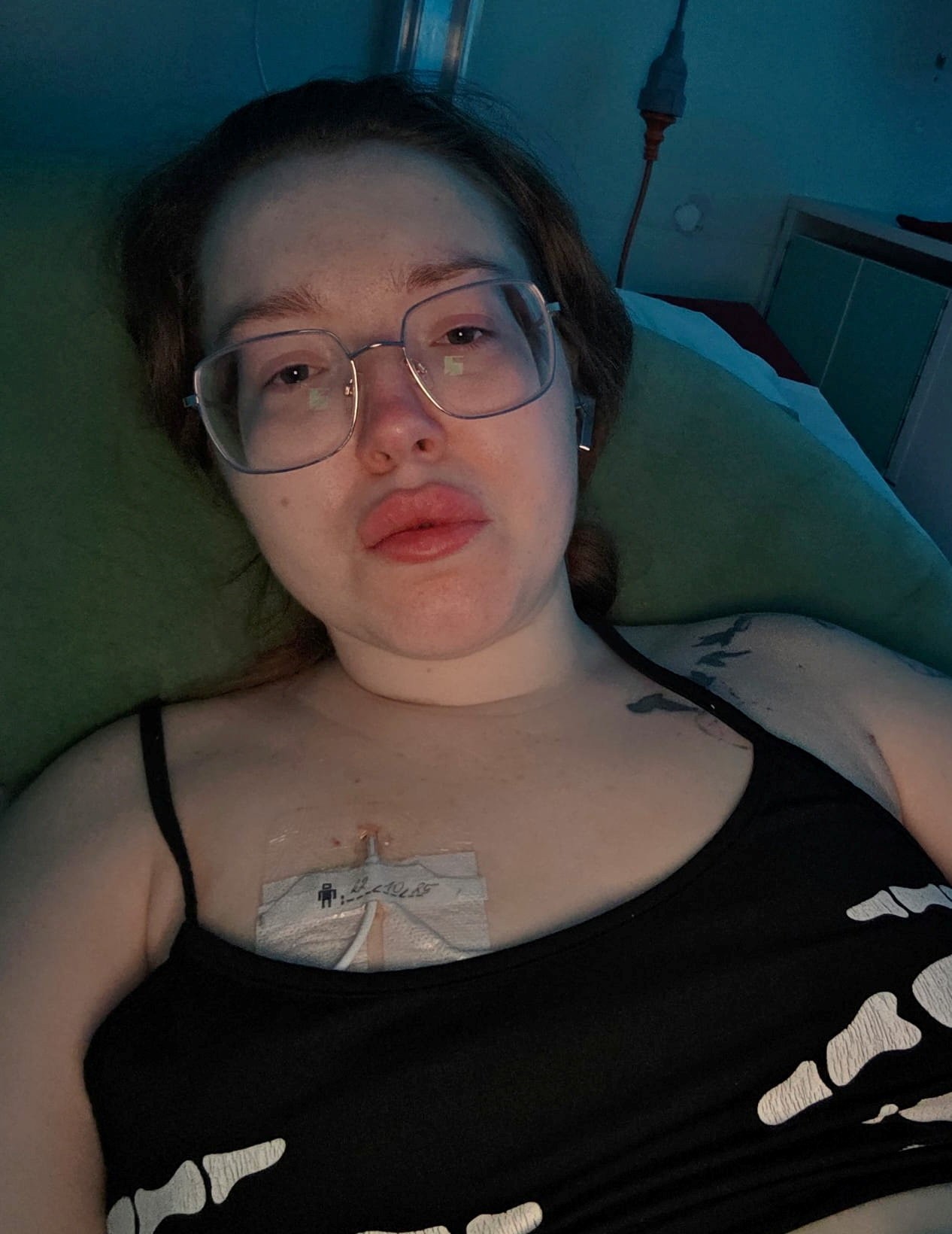 Chelsea Shields zažila pár dní po svadbe šok.