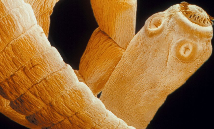 Jak usunąć pasożyty z organizmu