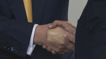 Az amerikai elnök kezén lévő zúzódást korábban már lefényképezték, amikor februárban találkozott Emmanuel Macron francia elnökkel. Ezt követően folyamatos találgatások tárgya volt az, hogy mit próbálnak sminkkel eltakarni Trump kezén.