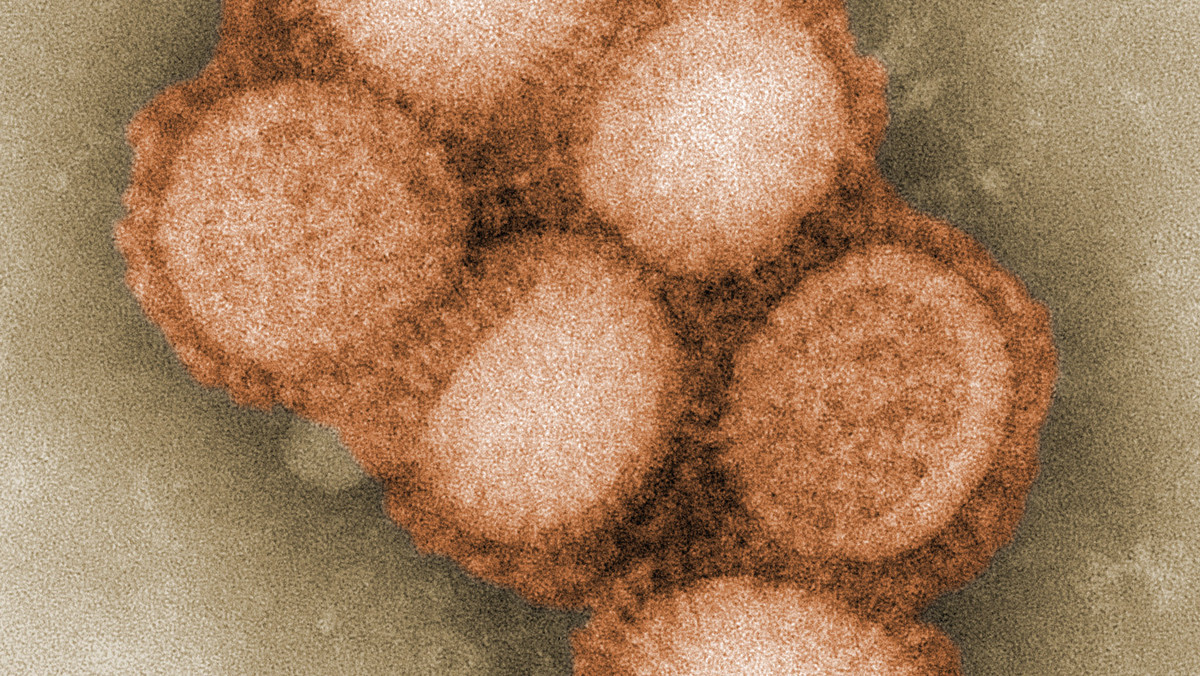 W szpitalach w Bielsku-Białej i Nowym Targu zmarły dwie osoby, u których potwierdzono zakażenie wirusem tzw. świńskiej grypy.
