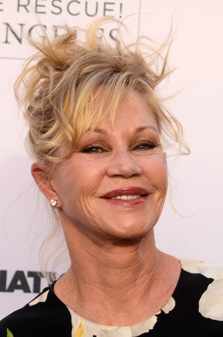 Žrtva plastične hirurgije