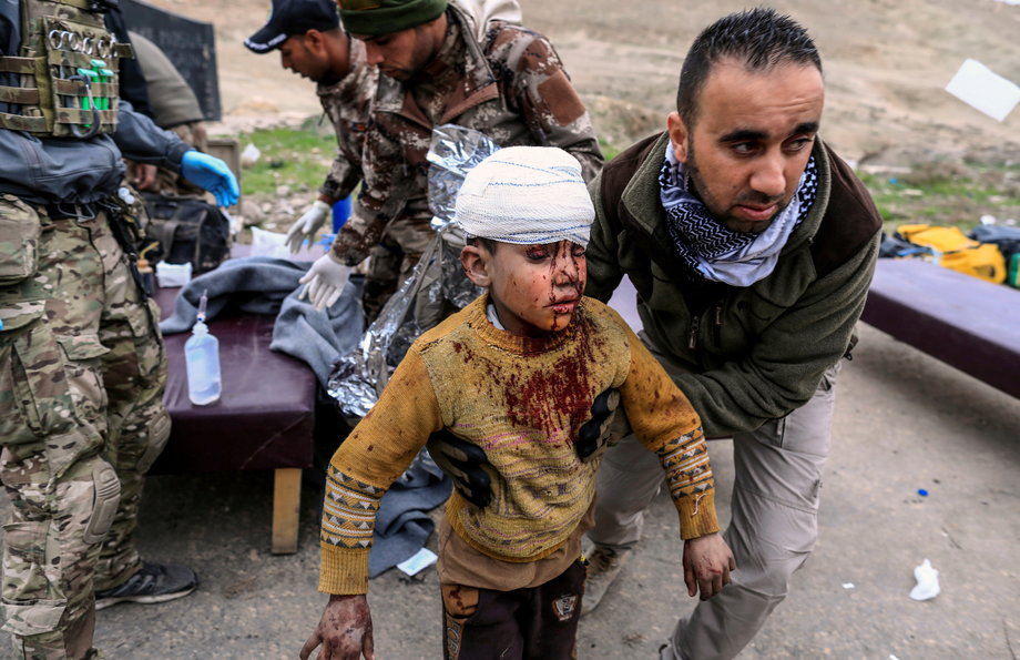 A boy injured in a mortar attack walks toward an ambulance after being treated by medics in a field clinic as Iraqi forces battle with ISIS militants, in western Mosul.